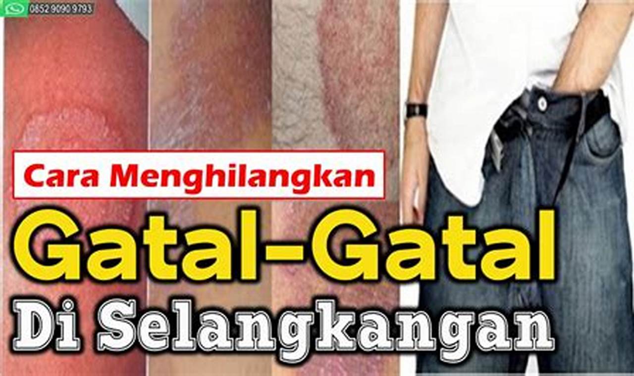 cara mengatasi gatal di selangkangan